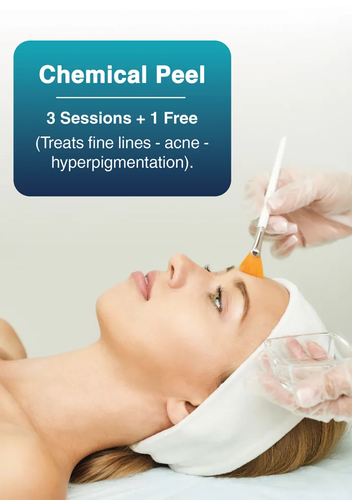 Chemical Peel package
